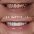 Фото компанії Стоматологія "DR. HARCHENKO CLINIC"