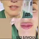 Фото компанії Beauty touch і Здоров'я тіла