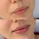 Фото компанії Центр естетичної косметології "Dr. Kozub. Cosmetology"