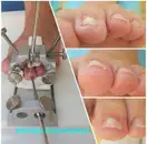 Фото компанії Центр подології  "Foot praktik"