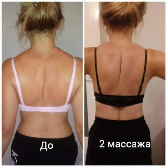 Фото компанії Масажист-реабілітолог