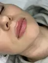 Фото компанії Doc_cosmetologist_bordyakivska