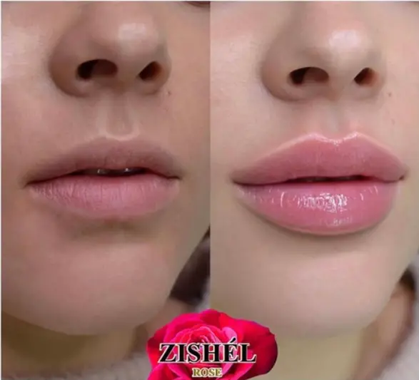 Фото компанії Косметологія "Beautymed"