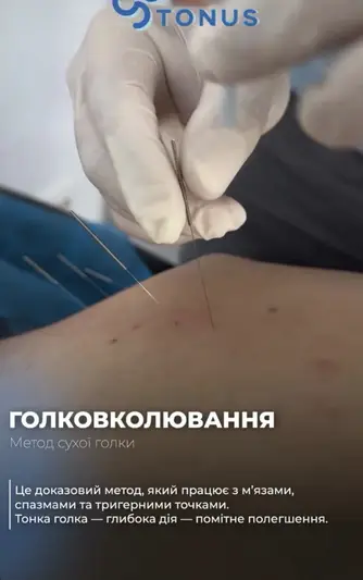 Фото компанії Реабілітаційний центр "Tonus"