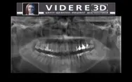 Фото компанії Центр щелепно-лицевої діагностики "Videre_3d"
