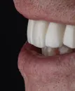 Фото компанії Dental Cad Design