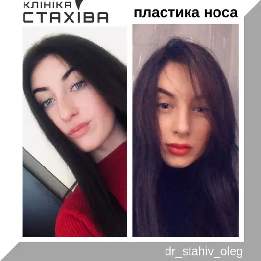Фото компанії ТОВ "Клініка ЛОР ендоскопічної та пластичної хірургії Стах +