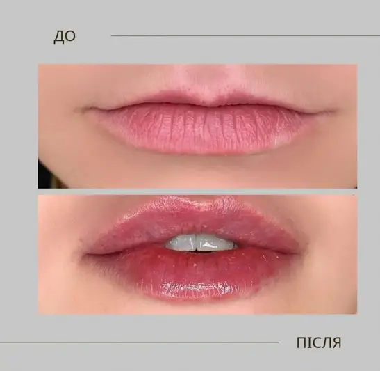 Фото компанії Li_clinique