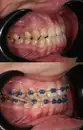 Фото компанії Стоматологія "DentFil"