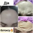 Фото компанії Лікар-косметолог "Тетяна"