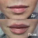 Фото компанії Студія Косметології