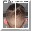 Фото компанії ТОВ "Клініка ЛОР ендоскопічної та пластичної хірургії Стах +