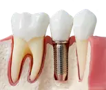 Фото компанії Perfect Dental
