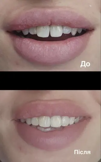 Фото компанії Стоматологія "Я.К."