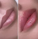 Фото компанії Yara Lips
