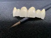 Фото компанії Зуботехнічна лабораторія "3D Dental"