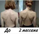 Фото компанії Масажист-реабілітолог