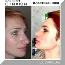 Фото компанії ТОВ "Клініка ЛОР ендоскопічної та пластичної хірургії Стах +