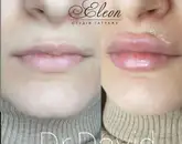Фото компанії Beauty salon "Eleon"