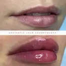 Фото компанії Aesthetic love