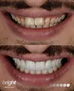 Фото компанії Bright.dental.space