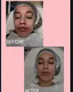 Фото компанії Косметолог "Віра Кузенко"
