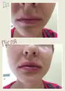 Фото компанії Дермато-косметологічний центр