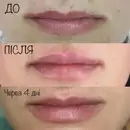 Фото компанії Mila cosmetolog.if