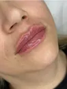 Фото компанії Doc_cosmetologist_bordyakivska