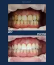 Фото компанії Gorgiev Dental Studio