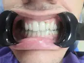 Фото компанії Yeremchuk Dental