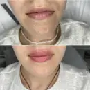 Фото компанії Dr. Osadtsa cosmetologist