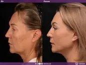 Фото компанії Клініка естетичної медицини "Vidnova"