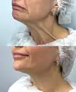Фото компанії Косметолог "dr.tymchuk"