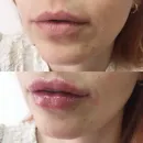 Фото компанії Cosmetologist Oksana Vakaliuk