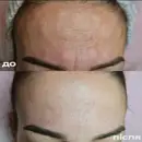 Фото компанії Cosmetolog "Vitaliiaa"
