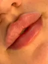 Фото компанії Косметолог "Lipslviv"