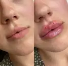 Фото компанії Julia Pun Cosmetologist