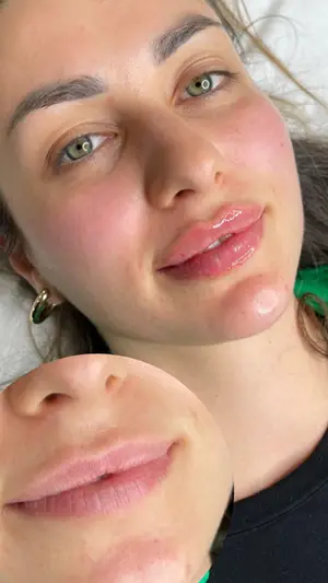 Фото компанії Косметологія "MARIANA.MOS.MEDICAL"
