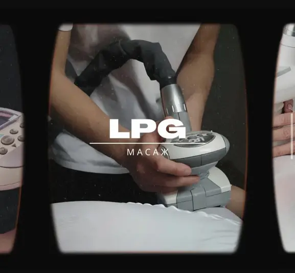 Фото компанії Amio LPG