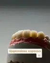 Фото компанії Зуботехнічна лабораторія "Pan Lab"