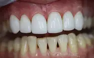 Фото компанії Perfect Dental