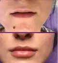 Фото компанії Косметологія "Beautymed"