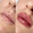 Фото компанії Perfect_skin_if