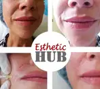 Фото компанії Косметологічно-масажна клініка "Esthetic hub"