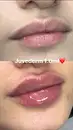 Фото компанії Cosmetologist Oksana Vakaliuk