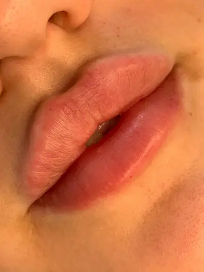 Фото компанії Косметолог "Lipslviv"