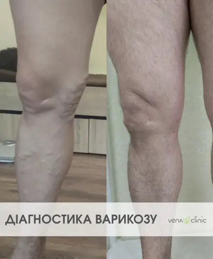 Фото компанії Медичний центр "VENA CLINIC"