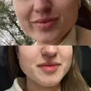 Фото компанії Косметологія Софії Бондар