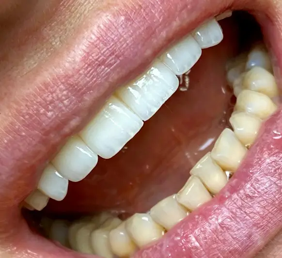 Фото компанії Implant D.Center лікаря Дацюк В.А.